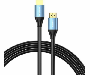 HDMI 2.0 Cable Vention ALHSE, 0,75m, 4K 60Hz, 30AWG (Blue)